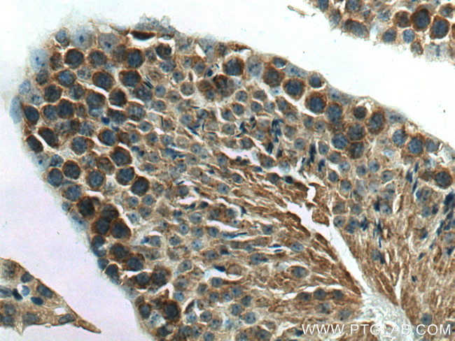 NEU3 Antibody in Immunohistochemistry (Paraffin) (IHC (P))