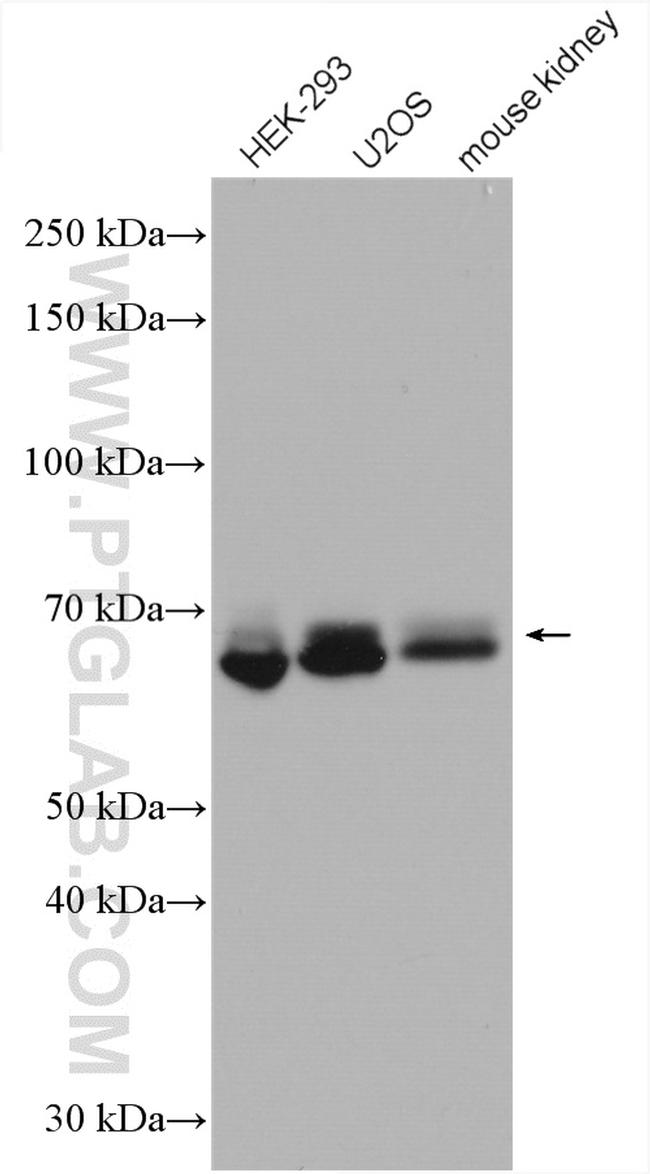 KIAA2013 Antibody in Western Blot (WB)