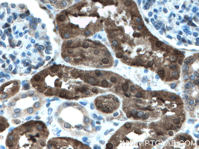 PBLD Antibody in Immunohistochemistry (Paraffin) (IHC (P))