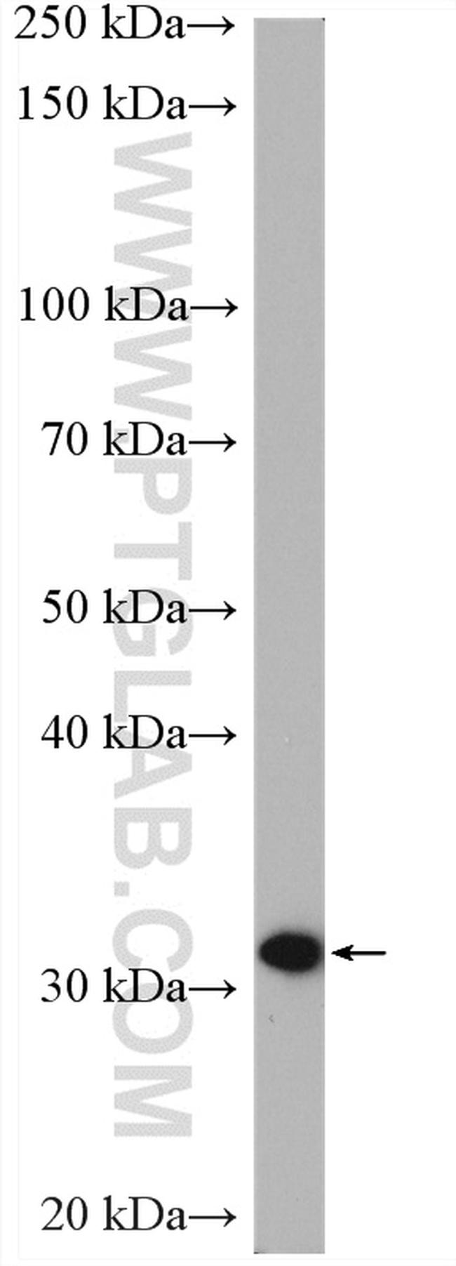 PBLD Antibody in Western Blot (WB)