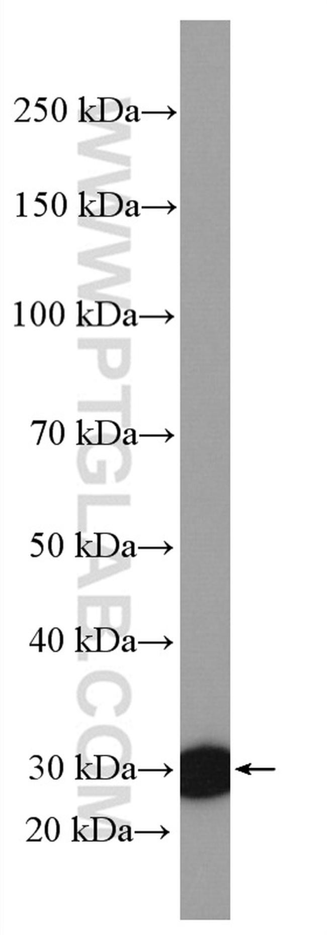 PBLD Antibody in Western Blot (WB)