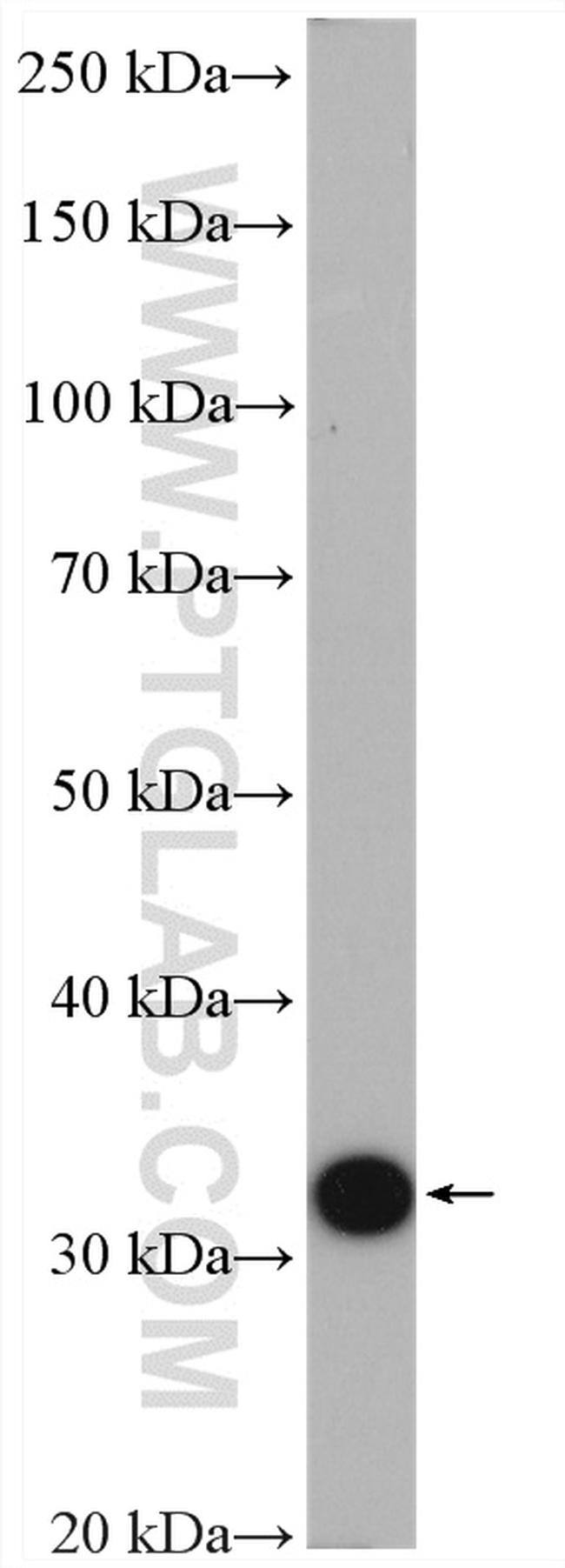 PBLD Antibody in Western Blot (WB)