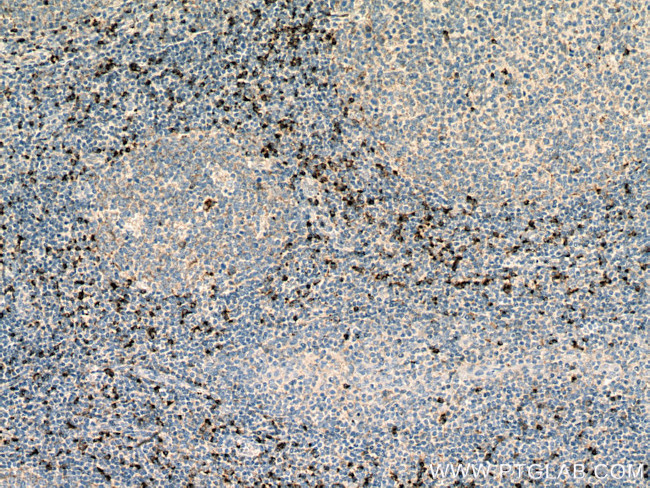 Granzyme K Antibody in Immunohistochemistry (Paraffin) (IHC (P))