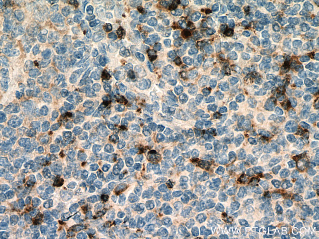 Granzyme K Antibody in Immunohistochemistry (Paraffin) (IHC (P))