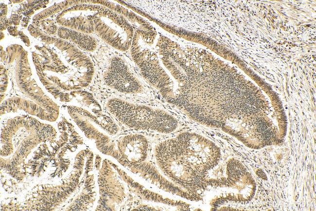 CRM1 Antibody in Immunohistochemistry (Paraffin) (IHC (P))