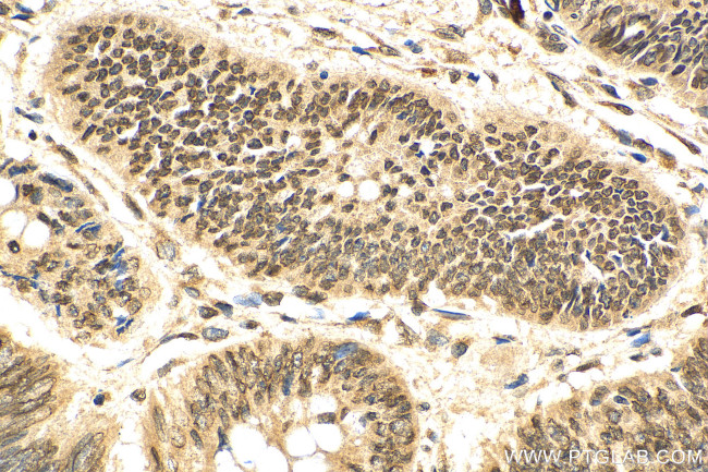 CRM1 Antibody in Immunohistochemistry (Paraffin) (IHC (P))