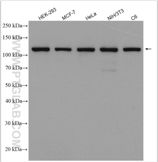 CRM1 Antibody in Western Blot (WB)