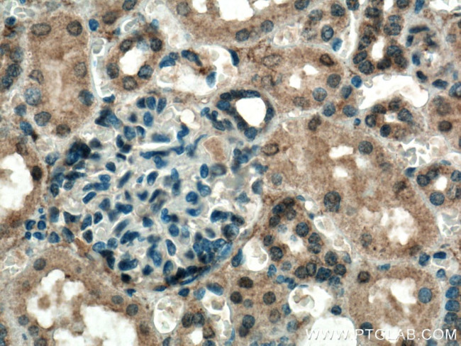 C1orf35 Antibody in Immunohistochemistry (Paraffin) (IHC (P))