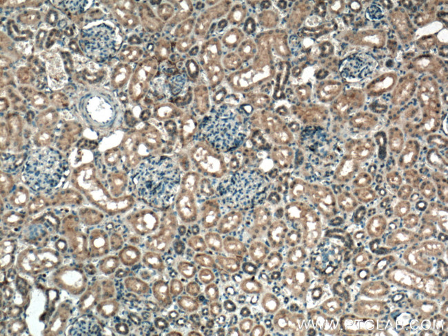 C1orf35 Antibody in Immunohistochemistry (Paraffin) (IHC (P))