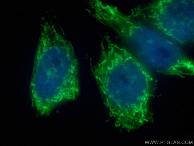 NDUFB4 Antibody in Immunocytochemistry (ICC/IF)