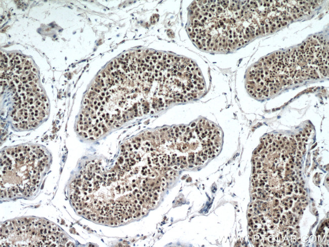 PAK6 Antibody in Immunohistochemistry (Paraffin) (IHC (P))