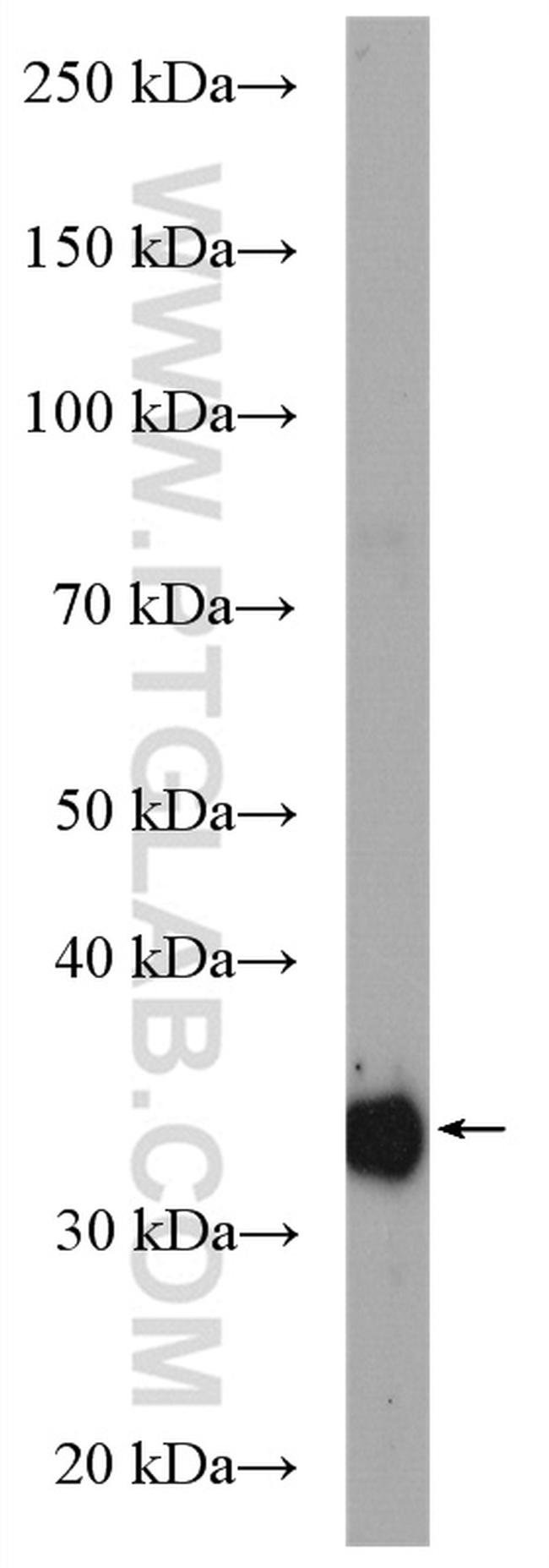 GPD1 Antibody in Western Blot (WB)