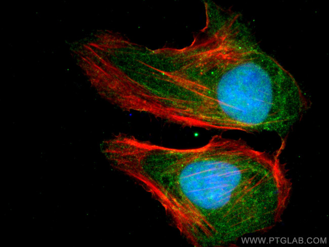 DROSHA Antibody in Immunocytochemistry (ICC/IF)