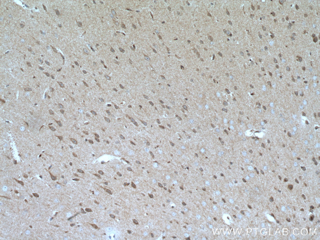 GBA Antibody in Immunohistochemistry (Paraffin) (IHC (P))