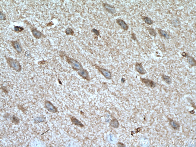 GBA Antibody in Immunohistochemistry (Paraffin) (IHC (P))