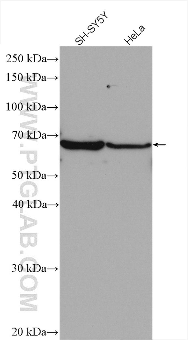 GBA Antibody in Western Blot (WB)