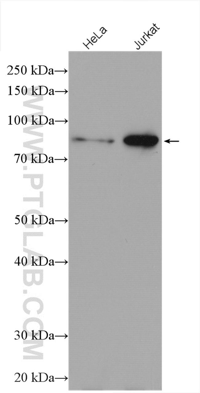 ZBTB24 Antibody in Western Blot (WB)