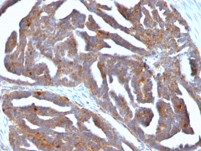 GnRH-Receptor/LH-RH Receptor Antibody in Immunohistochemistry (Paraffin) (IHC (P))