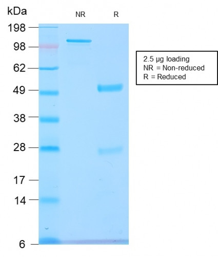 GnRH-Receptor/LH-RH Receptor Antibody in SDS-PAGE (SDS-PAGE)