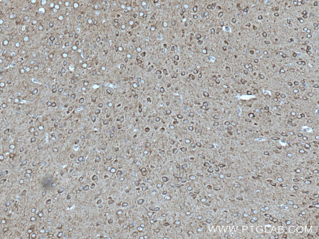 ANK3 Antibody in Immunohistochemistry (Paraffin) (IHC (P))