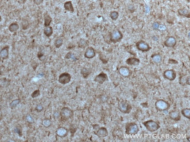 ANK3 Antibody in Immunohistochemistry (Paraffin) (IHC (P))