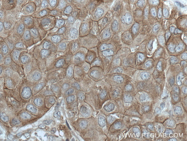 ANK3 Antibody in Immunohistochemistry (Paraffin) (IHC (P))