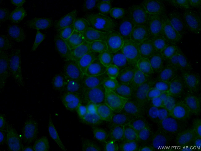 ANK3 Antibody in Immunocytochemistry (ICC/IF)