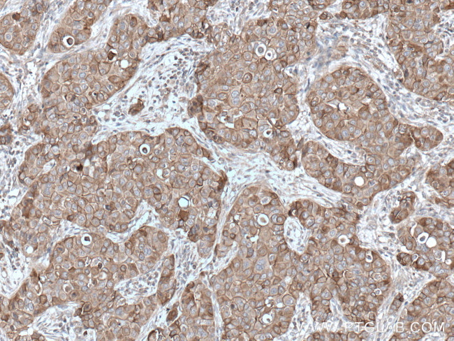 ANK3 Antibody in Immunohistochemistry (Paraffin) (IHC (P))