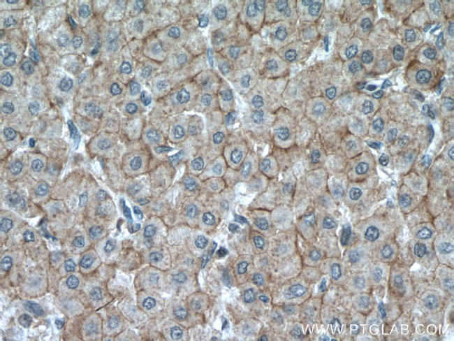 SLC22A9 Antibody in Immunohistochemistry (Paraffin) (IHC (P))