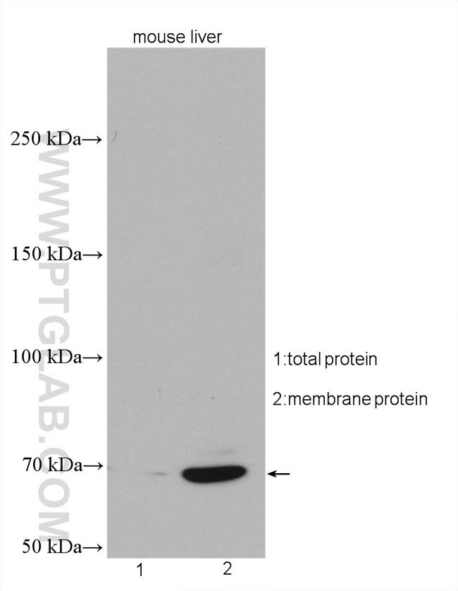 SLC22A9 Antibody in Western Blot (WB)