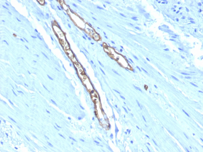 Blood Group Antigen A (CD173) Antibody in Immunohistochemistry (Paraffin) (IHC (P))