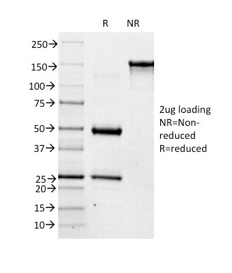 Blood Group Antigen A (CD173) Antibody in SDS-PAGE (SDS-PAGE)