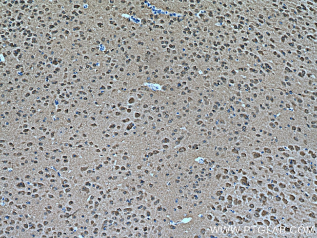 MAPK8/9/10 Antibody in Immunohistochemistry (Paraffin) (IHC (P))