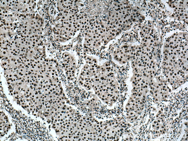 BPTF Antibody in Immunohistochemistry (Paraffin) (IHC (P))