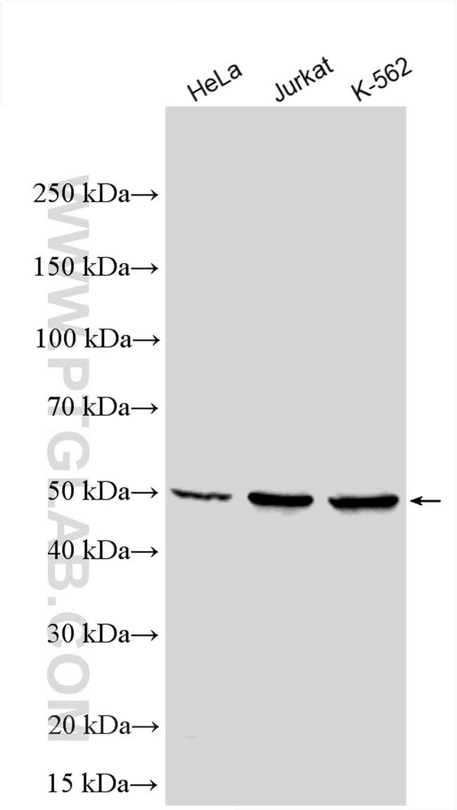 VRK1 Antibody in Western Blot (WB)