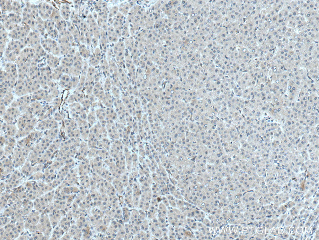 ATG14 Antibody in Immunohistochemistry (Paraffin) (IHC (P))