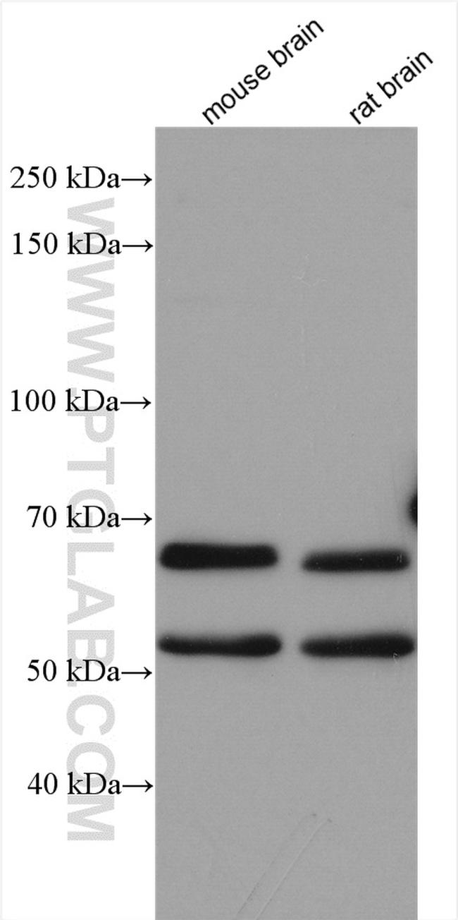 ATG14 Antibody in Western Blot (WB)