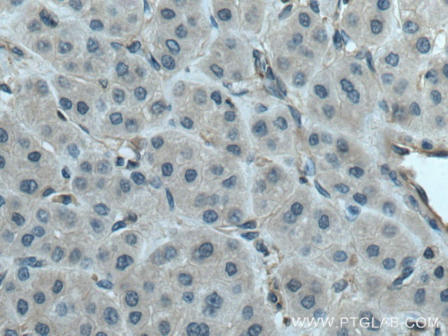 PLSCR3 Antibody in Immunohistochemistry (Paraffin) (IHC (P))