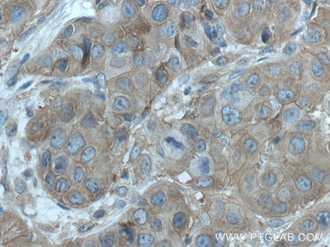 PLSCR3 Antibody in Immunohistochemistry (Paraffin) (IHC (P))