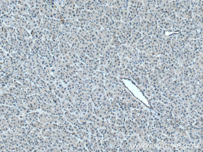 PLSCR3 Antibody in Immunohistochemistry (Paraffin) (IHC (P))