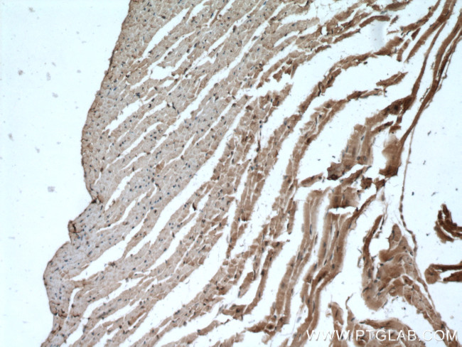 FADS2 Antibody in Immunohistochemistry (Paraffin) (IHC (P))