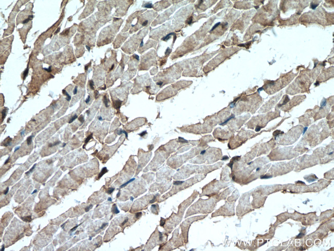 FADS2 Antibody in Immunohistochemistry (Paraffin) (IHC (P))