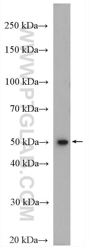 FADS2 Antibody in Western Blot (WB)