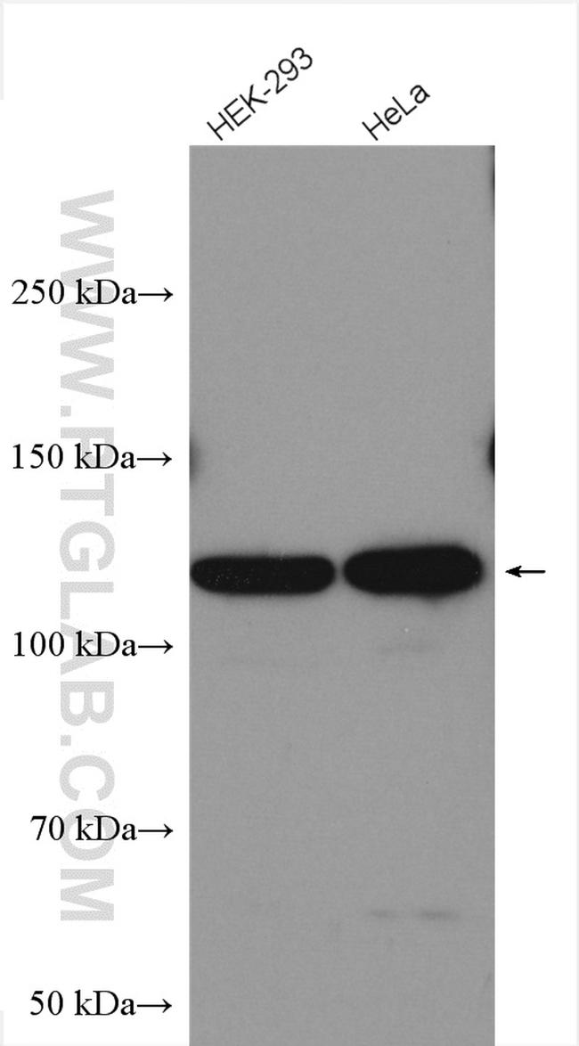 SMG8 Antibody in Western Blot (WB)