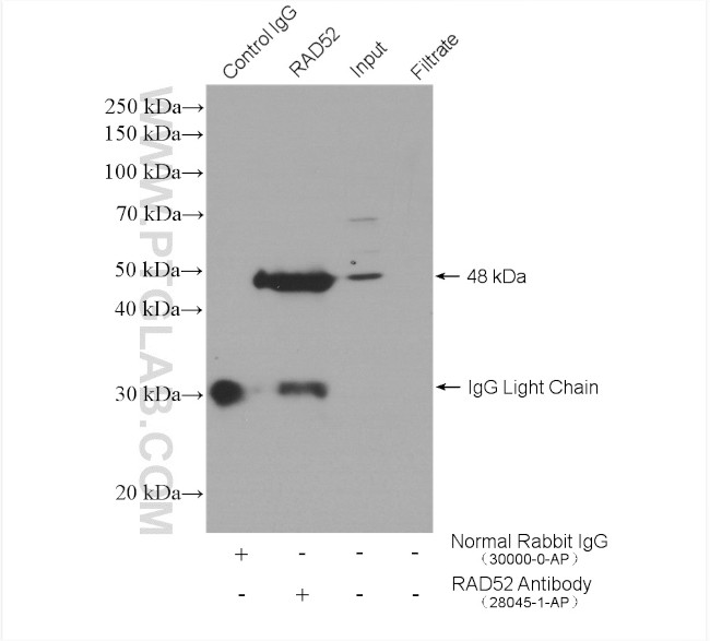 RAD52 Antibody in Immunoprecipitation (IP)