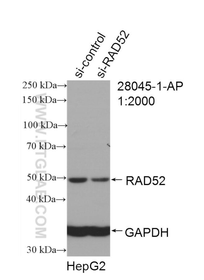 RAD52 Antibody in Western Blot (WB)