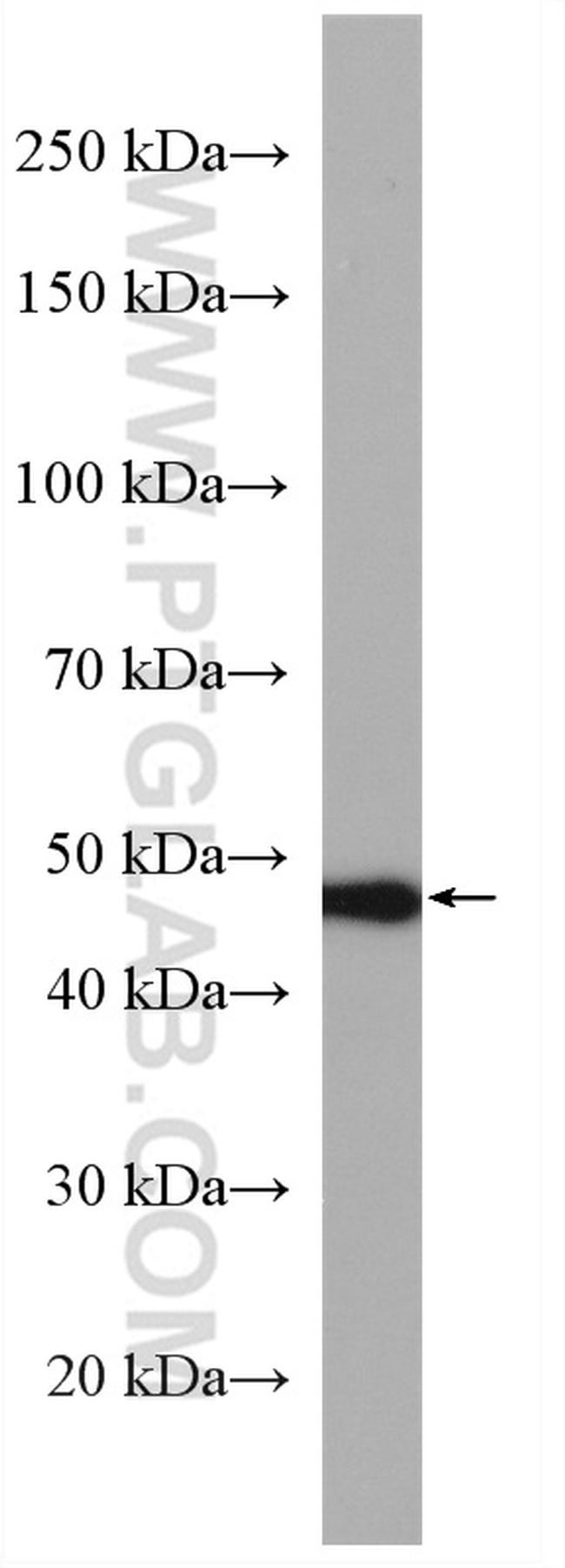 RAD52 Antibody in Western Blot (WB)