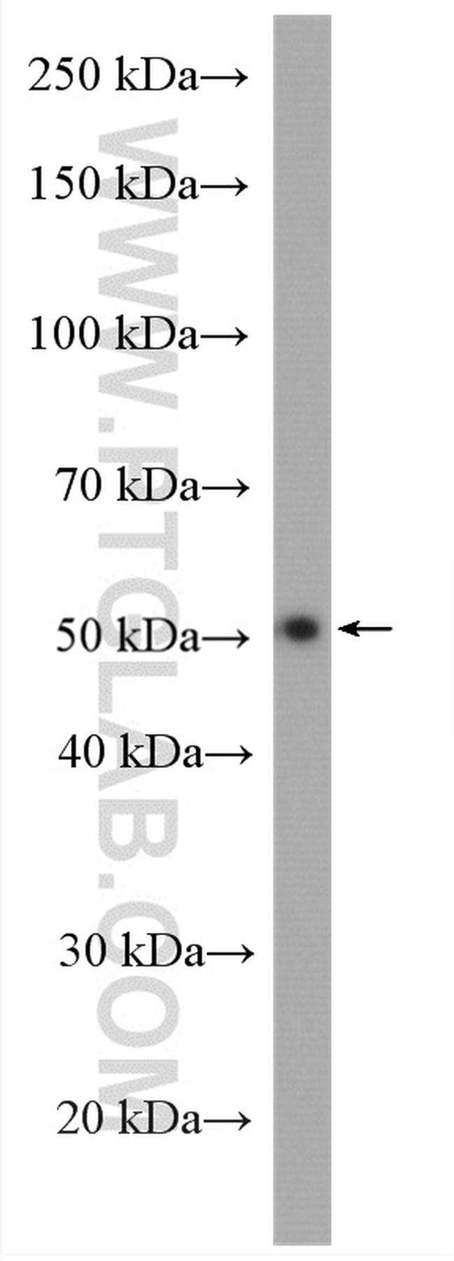 PPARD Antibody in Western Blot (WB)