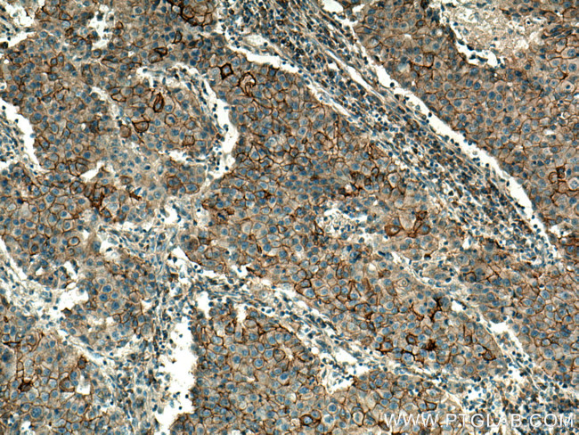 SLC12A2 Antibody in Immunohistochemistry (Paraffin) (IHC (P))