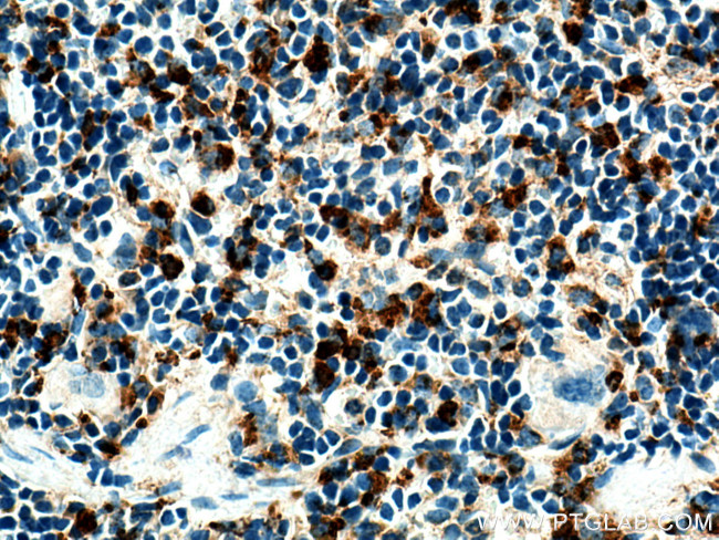 Cd68 Antibody in Immunohistochemistry (Paraffin) (IHC (P))